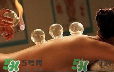 拔火罐疼嗎？拔火罐疼不疼