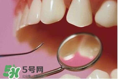 牙周炎傳染嗎？牙周炎會不會傳染