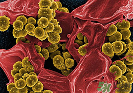 李斯特菌的感染癥狀?李斯特菌易感人群 李斯特菌的感染癥狀?李斯特菌易感人群