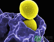 李斯特菌的感染癥狀?李斯特菌易感人群 李斯特菌的感染癥狀?李斯特菌易感人群