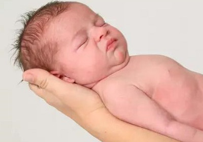 新生兒臉上長脂肪粒怎么辦 新生兒臉上長脂肪粒什么原因 新生兒臉上長脂肪粒怎么辦 新生兒臉上長脂肪粒什么原因