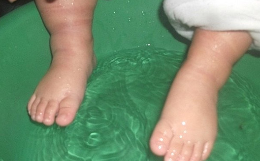 哪些人不適合泡腳？哪些人不宜泡腳