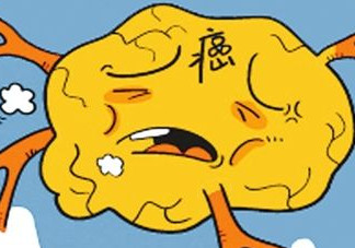 胃癌是怎么引起的？胃癌的早起癥狀