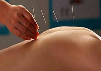 陰雨天能針灸嗎？陰雨天可以針灸嗎