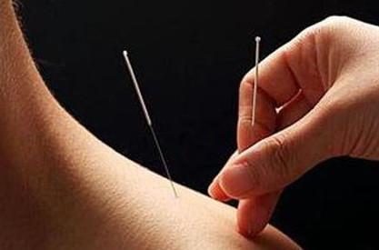 陰雨天能針灸嗎？陰雨天可以針灸嗎