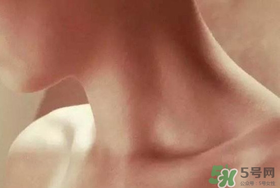 頸椎老化是什么病？頸椎老化的癥狀