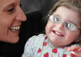 什么是早衰癥？早衰癥初期癥狀