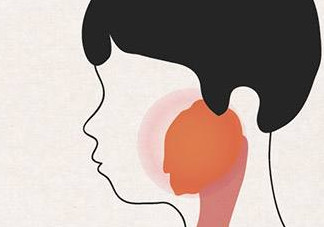 流行性腮腺炎有哪些癥狀？流行性腮腺炎的癥狀