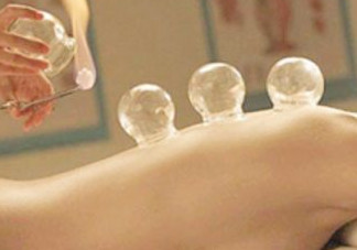 刮痧后可以拔罐嗎？刮痧后能拔火罐嗎