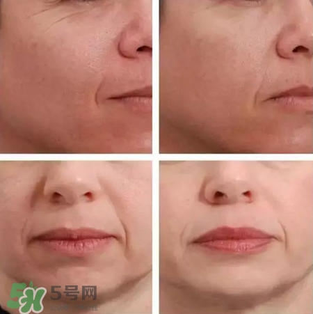 newa妞娃射頻美容儀多少錢(qián)?newa美容儀價(jià)格