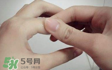 痛風有什么癥狀？女性痛風的初期癥狀