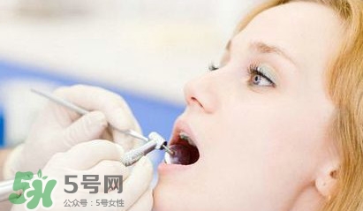 牙齒松動能自己恢復嗎？牙齒松動會自己恢復嗎