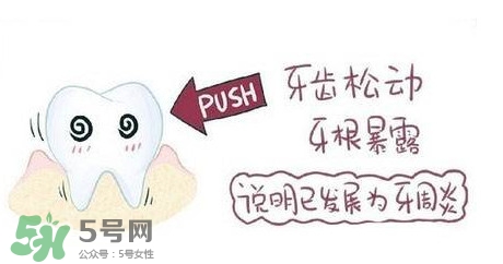 牙齒松動能自己恢復嗎？牙齒松動會自己恢復嗎