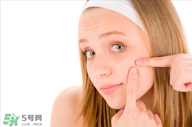 得了痤瘡飲食注意什么？有痤瘡吃東西注意什么