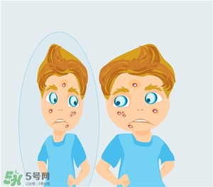 得了痤瘡飲食注意什么？有痤瘡吃東西注意什么