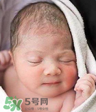 奶癬可以用奶水去除嗎？奶癬可以用奶水擦嗎？