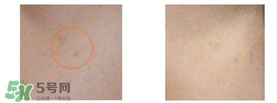 資生堂悅薇和新透白哪個好？資生堂悅薇和新透白對比