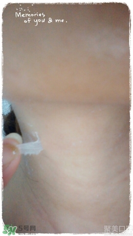 藍(lán)紫根頸膜效果怎么樣？藍(lán)紫根頸膜有沒(méi)有效果？