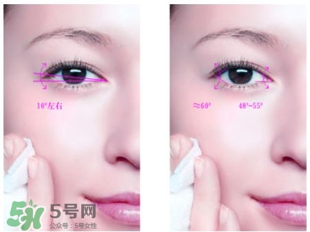 開眼角可以吃醬油嗎?開眼角吃醬油好嗎? 開眼角可以吃醬油嗎?開眼角吃醬油好嗎?