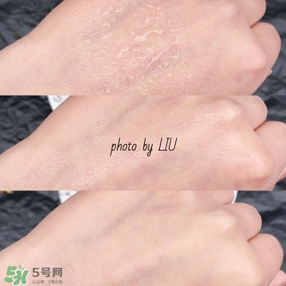 美帕b5噴霧有激素嗎？美帕噴霧副作用