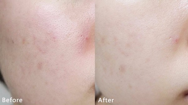 春雨黃油面膜貼怎么用？春雨黃油面膜使用方法