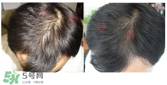  資生堂不老林洗發(fā)水怎么樣？資生堂不老林洗發(fā)水能長頭發(fā)嗎