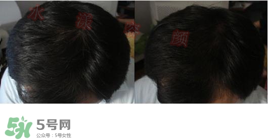  資生堂不老林洗發(fā)水怎么樣？資生堂不老林洗發(fā)水能長頭發(fā)嗎