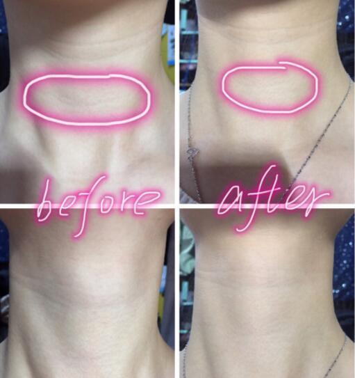 天鵝頸是什么樣的？天鵝頸怎么練？