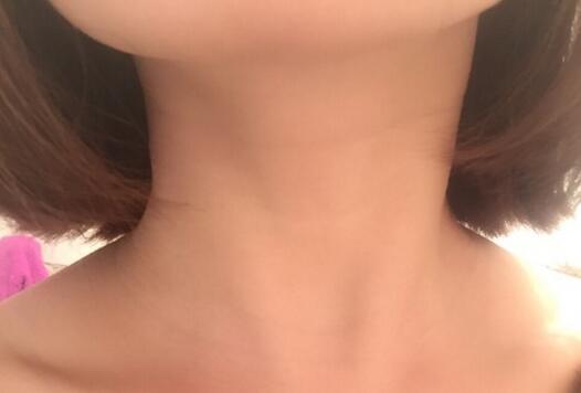 天鵝頸是什么樣的？天鵝頸怎么練？