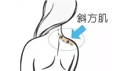 天鵝頸是什么樣的？天鵝頸怎么練？