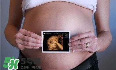 四維彩超能看出男女嗎？四維彩超能看清手指嗎？