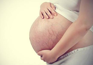 妊娠紋什么時候長出來？哪種皮膚容易長妊娠紋？