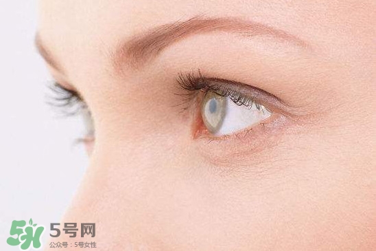 眼睛布滿血絲怎么回事？眼睛布滿血絲怎么辦