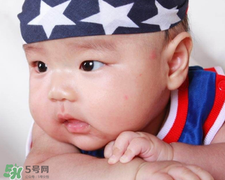 嬰兒被蚊子咬了如何去紅點(diǎn)？被蚊子咬后紅點(diǎn)如何去除？