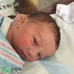 新生兒手握避孕環(huán)出生是怎么回事？出生后健康嗎？