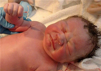 新生兒手握避孕環(huán)出生是怎么回事？出生后健康嗎？