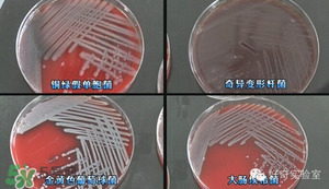 三文魚有刺嗎？三文魚的刺怎么處理