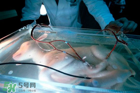 人造子宮能生孩子嗎？人造子宮成功案例