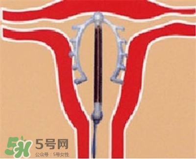 避孕環(huán)安全嗎？避孕環(huán)是什么樣子的圖片