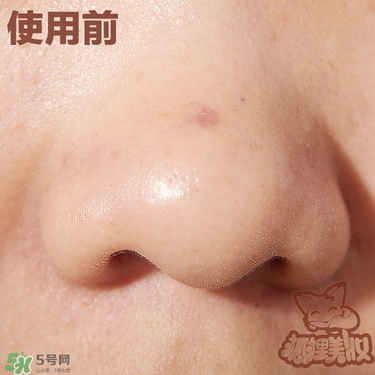 melty berry去黑頭使用方法 melty berry草莓鼻去黑頭怎么用 melty berry去黑頭使用方法 melty berry草莓鼻去黑頭怎么用