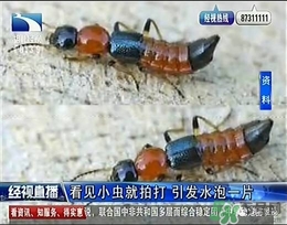 隱翅蟲有毒嗎？隱翅蟲會毀容嗎？