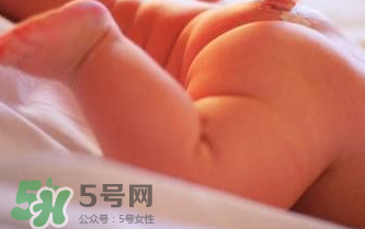 寶寶尿布疹可以擦紅霉素軟膏嗎？紅霉素軟膏對(duì)尿布疹有效嗎？