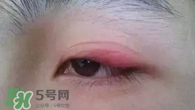 長(zhǎng)期用假睫毛雙眼皮貼對(duì)眼睛有什么傷害？