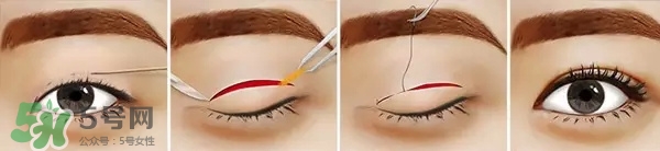 長(zhǎng)期用假睫毛雙眼皮貼對(duì)眼睛有什么傷害？