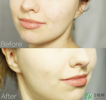 雅詩(shī)蘭黛小棕瓶套裝怎么用效果最好 雅詩(shī)蘭黛小棕瓶套裝怎么用效果最好