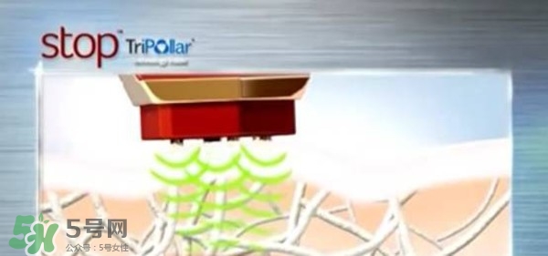 tripollar stop怎么樣？tripollar pose好用嗎