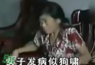 狂犬病能治好嗎？狂犬病的早期癥狀