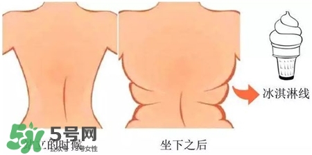 冰淇淋線是什么?有冰淇淋線怎么辦? 冰淇淋線是什么?有冰淇淋線怎么辦?