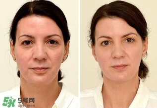 30天不喝飲料，妹子的對比照令人震驚 喝白開水的好處