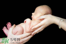 寶寶臍帶掉了要緊嗎？寶寶臍帶掉了出血了怎么辦？